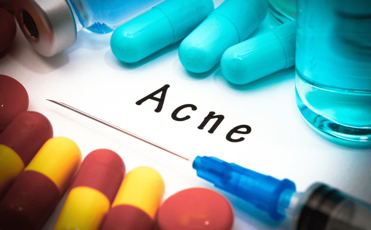 tratamento para acne com roacutan